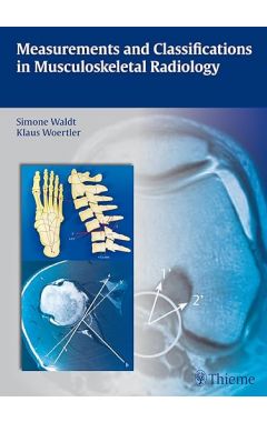 Measurements and Classifications in Musculoskeletal Radiology