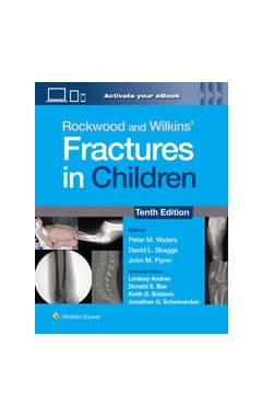 Rockwood and Wilkins' Fractures in Children