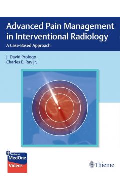 Advanced Pain Management in Interventional Radiology