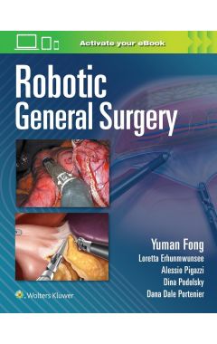 Robotic General Surgery