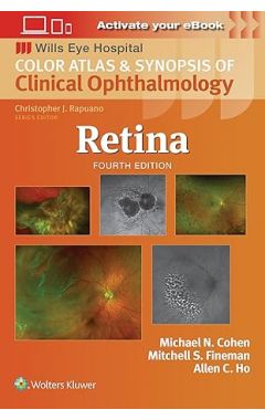 Retina