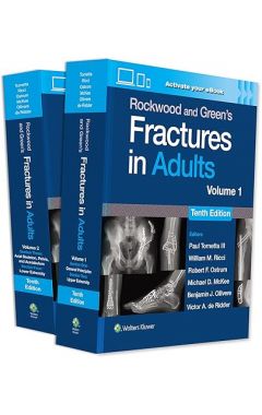 Rockwood and Green's Fractures in Adults: Print + eBook with Multimedia