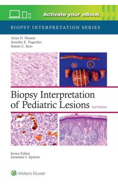 Biopsy Interpretation of Pediatric Lesions: Print + eBook with Multimedia