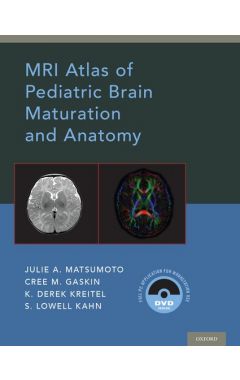 MRI Atlas of Pediatric Brain Maturation and Anatomy