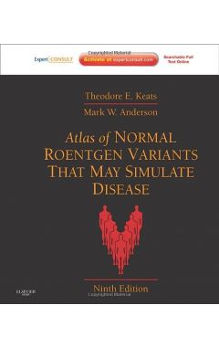 Atlas of Normal Roentgen Variants That May Simulate Disease: Expert Consult - Enhanced Online Features and Print