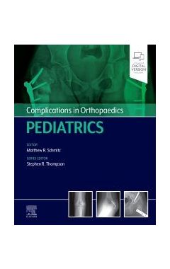 Complications in Orthopaedics: Pediatrics