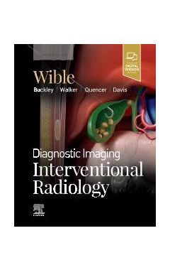 Diagnostic Imaging: Interventional Radiology