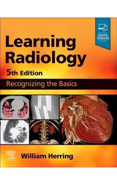 Learning Radiology: Recognizing the Basics