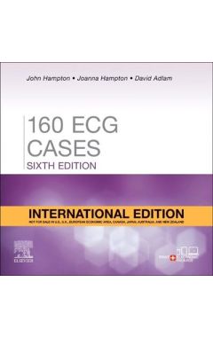 150 ECG Cases, International Edition: 150 ECG Cases, International Edition