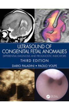 Ultrasound of Congenital Fetal Anomalies Differential Diagnosis and Prognostic Indicators 3e