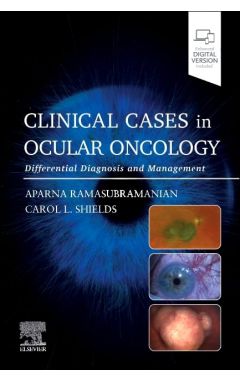 Clinical Cases in Ocular Oncology: Differential Diagnosis and Management