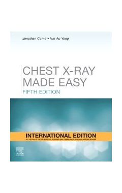 Chest X-Ray Made Easy 5e IE