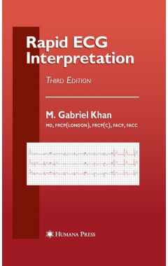 Rapid ECG Interpretation