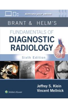 Brant & Helm's Fundamentals of Diagnostic Radiology: Print +    eBook with Multimedia